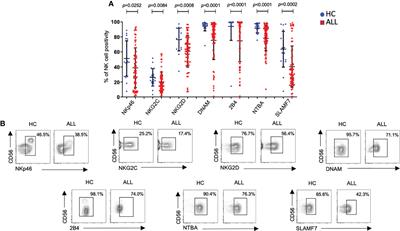 NK cells with decreased expression of multiple activating receptors is a dominant phenotype in pediatric patients with acute lymphoblastic leukemia